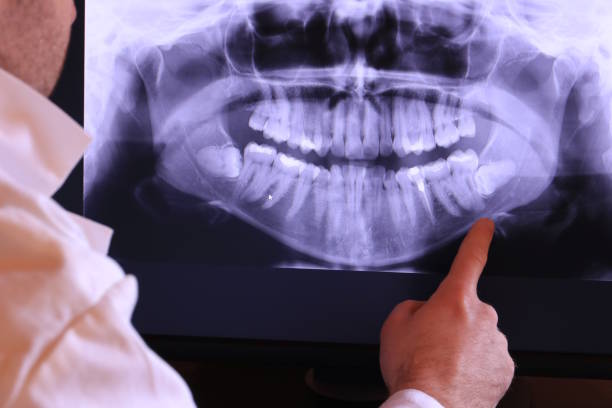 Best Emergency Dental Services for Seniors in Avimor, ID